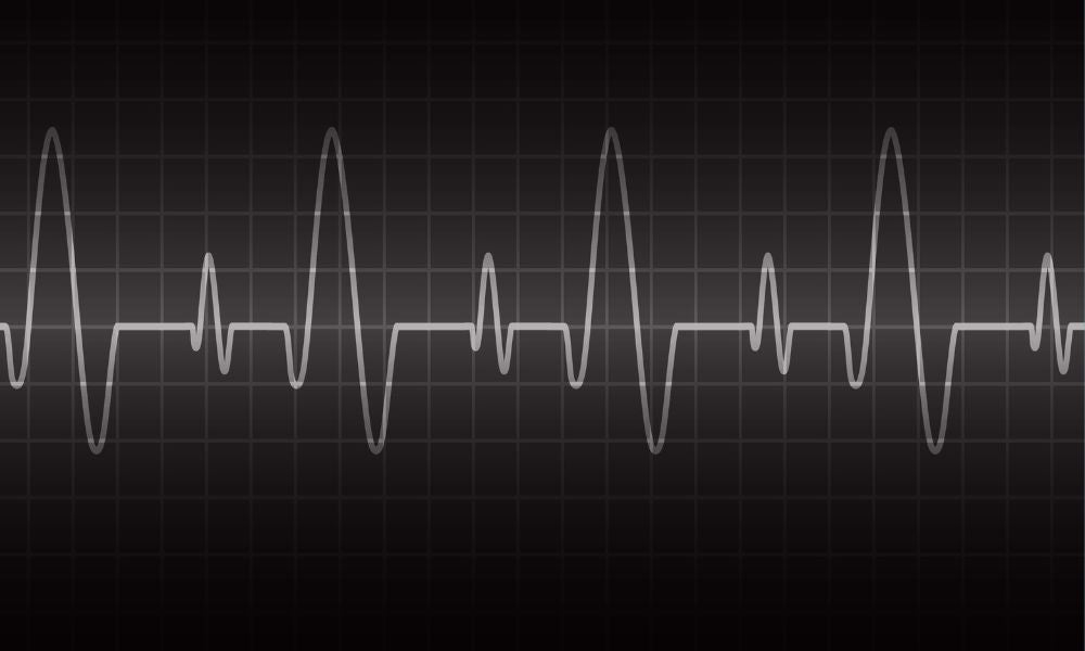 What is Heart Rate Controlled Training?